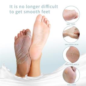 img 3 attached to 🦶 Foot Mask-5 Pack for Silky Soft Skin, Natural Exfoliating Foot Care Treatment to Repair Cracked Heels, Callus Removal, and Dead Skin Cell Peeling, Ideal for Men and Women (Milk & Avocado)