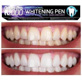 img 1 attached to 😁 Professional Quality Teeth Whitening Pens (3-Pack) - Noticeably Whiter Teeth - Affordable Tooth Whitening Solution for Sensitive Teeth - 35% Carbamide Peroxide
