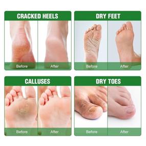 img 2 attached to 👣 Foot Peel Mask 6 Pack: Natural Exfoliating Treatment for Calluses & Rough Heels - Baby Foot Care Mask for Men & Women