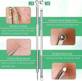 img 1 attached to 👩 Effective 5PCS Blackhead Remover Comedone Extractor: Curved Tweezers Kit, Professional Stainless Tools for Pimple Acne Blemish Removal