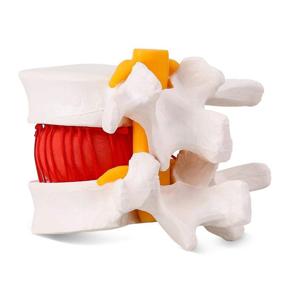 img 2 attached to 👩 Lumbar Herniation Model: Anatomically Accurate Representation for Studying Human Spine
