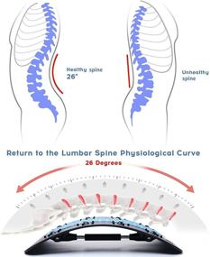 img 2 attached to 🔧 Революционный растяжитель спины: магнитные акупунктурные точки, регулируемый костыль для облегчения боли в спине - сколиоз, грыжа диска, сколиоз