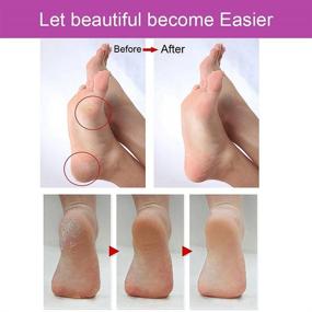 img 2 attached to 🦶 Experience Smooth Feet with Emjoi Micro-Pedi Callus Remover