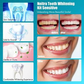 img 2 attached to Neitra Teeth Whitening Kit - Fastest 10 Minute Results, (4) 3ml Non-Sensitive Whitening Gel, 5LED Accelerator, Home Teeth Whitening Kit (Sensitive Series)