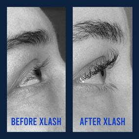 img 1 attached to Xlash A 01 Eyelash Serum 3Ml