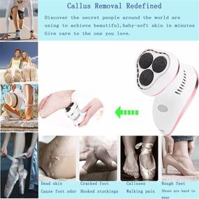 img 2 attached to 🌹 Rose Gold Electric Foot Callus Remover with Built-in Vacuum - Professional Pedicure Tool for Dead, Hard, Cracked, Dry Skin - Electric Vacuum Foot Grinder for Feet Care