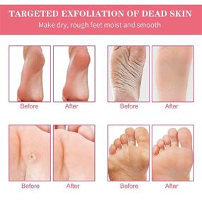 img 3 attached to 👣 Exfoliating Foot Peel Mask 3 Pack - Baby Foot Peel, Callus Remover for Feet, Peeling Feet Mask, Dead Skin Scrubber, Dermaplaning Tool, Exfoliating Callus Peel Booties (in Rose)