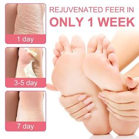 img 4 attached to 👣 Exfoliating Foot Peel Mask 3 Pack - Baby Foot Peel, Callus Remover for Feet, Peeling Feet Mask, Dead Skin Scrubber, Dermaplaning Tool, Exfoliating Callus Peel Booties (in Rose)