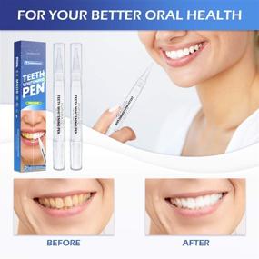 img 2 attached to 🦷 HOPEMATE Teeth Whitening Pen (2 Pens) - Professional Dental Whitener for a Bright, Flawless Smile