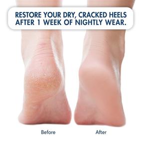 img 2 attached to 🧦 Moisturizing Heel Socks for Cracked Heel Treatment by Dr. Frederick - 2 Pairs - Effectively Prevent and Treat Cracked Heels