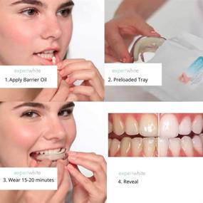 img 3 attached to 🦷 Expertwhite Preloaded Teeth Whitening Trays - 35% Strength Gel, 5 Individually Sealed Trays, 30-Minute Daily Treatment