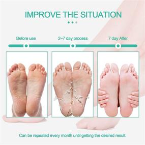 img 1 attached to Rosmax Foot Peel Mask Effective