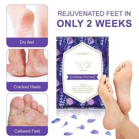 img 2 attached to Get Baby Soft Feet with Exfoliating Foot Peel Mask - 5 Pack! Remove Dead Skin, Calluses, & Repair Rough Heels. Enjoy Smooth & Silky Treatment with Lavender Scent.