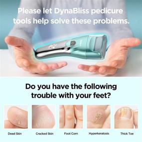 img 1 attached to 🦶 DynaBliss Upgraded Electric Callus Remover for Feet - 4 Roller Heads, LED Light, 2 Powerful Speed - Best for Hard Cracked Dry Dead Skin