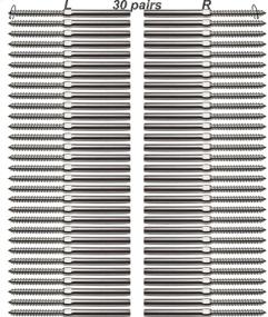 img 4 attached to 🔩 Lulultn T316 Stainless Steel Cable Railing Hardware System Kit for Wood Posts – 3/16 Inch, Swage Lag Screws Left & Right – 30 Pairs