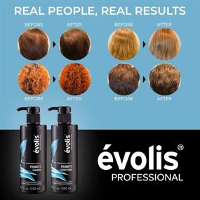 img 3 attached to évolis PROMOTE Shampoo & Conditioner: Boost Hair Growth | Sulfate Free & Color Safe | Repair Dry & Damaged Hair | Hair Growth Stimulating & Strengthening (8.5 fl oz Each)