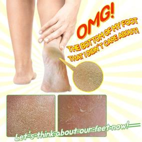 img 1 attached to 👣 Elizavecca Foot Peel: 1 пакет для одной стопы с 2 парами маски - эффективный отшелушивающий уход | Обзор с фото до и после.