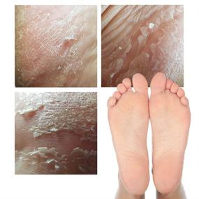 img 2 attached to 👣 Elizavecca Foot Peel: 1 пакет для одной стопы с 2 парами маски - эффективный отшелушивающий уход | Обзор с фото до и после.