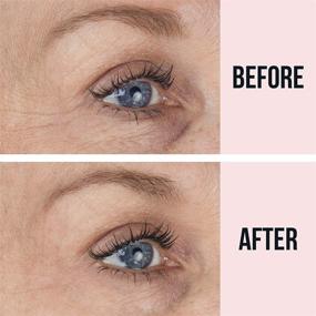 img 3 attached to 😊 SiO Beauty Eye and Smile Lift: The Ultimate 4 Week Supply for Wrinkle-Free Results - Say Goodbye to Dark Circles and Hello to Smooth Skin with Overnight Under Eye Mask Pads - Innovative Silicone Skin Treatment for Wrinkles