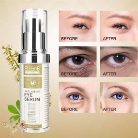 img 3 attached to Revitalize and Renew: Anti Ageing Eye Serum for Puffy Eyes, Dark Circles & Wrinkles