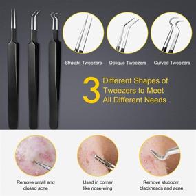 img 1 attached to Boxoyx Pimple Popper Tool Kit - 10 Pcs Blackhead Remover Comedone Extractor Kit with Metal Case for Quick and Easy Removal of Pimples, Blackheads, and Zits on the Face and Nose