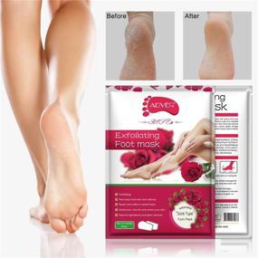 img 2 attached to 🌹 Repair Your Rough Heels with Foot Mask 3 Pack – Exfoliating Peel for Cracked Heels, Dead Skin & Calluses (Rose)