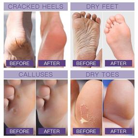 img 3 attached to 👣 Raxurt Foot Peel Exfoliating Mask 3 Pack: Say Goodbye to Rough, Cracked Heels and Dead Skin!