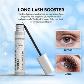 img 2 attached to Discover the Power of StormCom Advanced Eyelash Growth Serum - Enhance Your Brows and Lashes with Nourishing Formula - Cruelty Free, 5ML (0.17 fl/oz)