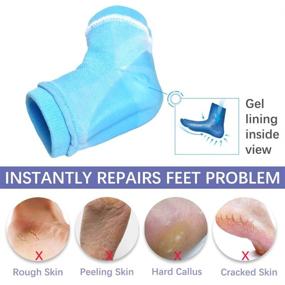 img 1 attached to 🧦 Hydrating Socks - Moisturizing & Gel Infused Heel Socks for Dry Cracked Heels, Open Toe Design, Breathable Spa Socks to Heal and Revitalize Dry Feet, Enhanced with Vitamin-Infused Gel Lining