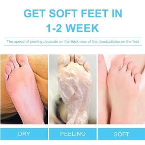 img 1 attached to Exfoliating Foot Peel Mask for Cracked Heels, Dead Skin & Calluses - Achieve Baby Soft Feet, Smooth Skin, and Repair Rough Heels with a Natural Treatment - Suitable for Women & Men (3 pack, Mike)