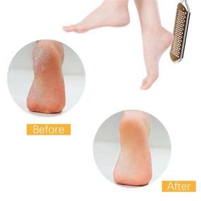 img 2 attached to Pedicure Foot File Callus Remover - Professional Stainless Steel Colossal Foot Rasp for Wet and Dry Feet (Athens Copper)