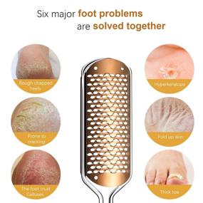 img 3 attached to Pedicure Foot File Callus Remover - Professional Stainless Steel Colossal Foot Rasp for Wet and Dry Feet (Athens Copper)