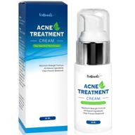 viebeauti acne treatment cream tree logo