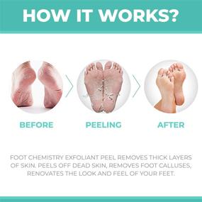 img 1 attached to 👣 FootChemistry 360 Foot Peel Mask - Exfoliating and Refreshing Cucumber Scented Foot Peeling Mask for Smooth, Soft Feet - Remove Dead Skin Cells, Calluses, and Repair Rough Heels in One Week - 1 Pack