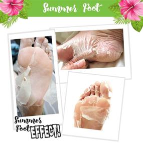 img 3 attached to Get Baby Soft Feet: Summer Foot Premium Green Edition Foot Mask - Exfoliating Peel & Callus Remover with one-time treatment for rough heels!