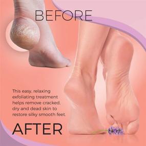 img 1 attached to 👣 Footeeze Foot Peel Mask - Dead Skin Remover for Feet. Foot Mask Peel for Dry Cracked Skin. Baby Feet Foot Peel 2 Pack - Foot Masks to Relax & Unwind