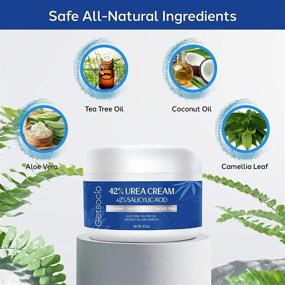 img 2 attached to 👣 Intensive Urea Cream with Salicylic Acid: Powerful Exfoliation & Moisturization for Dry Cracked Feet, Hands, Heels, Elbows, Knees - 4oz