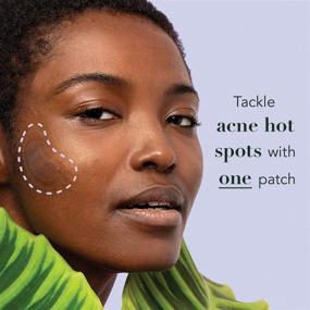 img 2 attached to 🌟 Rael Acne Pimple Healing Patch - Large Spot Control Cover: Long Size, Extra Coverage (10 Count)