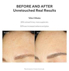 img 1 attached to 💤 Ночной крем Murad Resurgence Retinol Youth Renewal - Эффективный крем с ретинолом от морщин и морщин - Продвинутый ночной антивозрастной крем для лица - Уплотняющий и смягчающий ночной крем для лица, 1,7 жидк. унц.