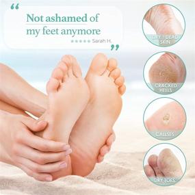 img 3 attached to Foot Peel Mask - Large Size: Repair Cracked Heels, Remove Dead Skin & Calluses, Get Baby Soft Feet & Smooth Skin - Exfoliating Peeling Natural Treatment (2 Pack)