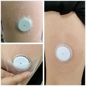 img 3 attached to 🩹 40-Pack Freestyle Libre Sensor Covers: Latex-Free CGM Adhesive Patches for Libre 2 with Precut Tape, Waterproof & Long-Lasting Stickiness, No Glue on Center