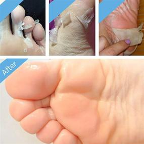 img 3 attached to 🦶 Soft Feet Solution: 4 Pack Foot Peel Mask for Removing Rough Heels, Effective Callus Remover & Exfoliator with Natural Ingredients