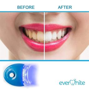 img 2 attached to EverWhite(TM) Teeth Whitening Accelerator Light - Experience 5x Faster Teeth Whitening Results with Powerful Blue LED Light