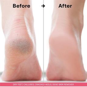 img 1 attached to 👣 VELAMO Foot Peel Mask - 2 Pairs for Cracked Heels, Dead Skin & Calluses - Repair Rough Heels & Get Silky Soft Feet in 1-2 Weeks - Ideal for Men & Women