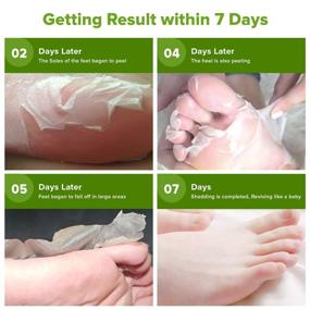 img 1 attached to 👣 2-Pair Exfoliating Foot Peel Masks: Natural Botanical In-Home Spa Treatment for Feet Peeling, Dead Skin Removal, Exfoliation Booties, Relieve Dry, Cracked Irritation. Includes Tweezers.