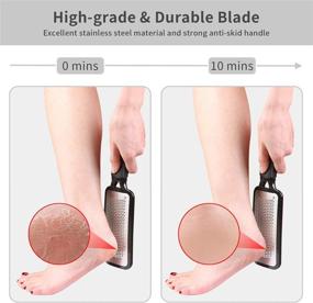 img 3 attached to 🦶 PediLux™: Large Stainless Steel Pedicure Foot File Callus Remover | Professional Foot Care Tool for Dry and Wet Feet | Remove Hard Skin with Ease