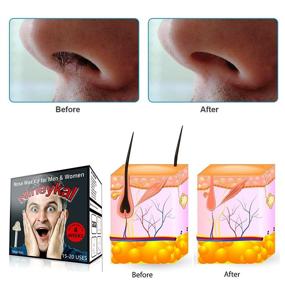 img 1 attached to Nose Waxing Kit 100g with 30 Applicators, 15-20 Uses, 10 After Wax Wipes, 10 Spatulas & 10 Mustache Protectors - Nose Hair Removal Wax for Men & Women, Easy & Painless