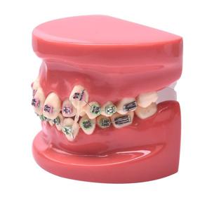 img 1 attached to 500-штуковые ортодонтические эластичные резинки AnhuaDental для брекетов, 3,5 унции тяжелые стоматологические резиновые тяговые бандажи (100 штук в упаковке)