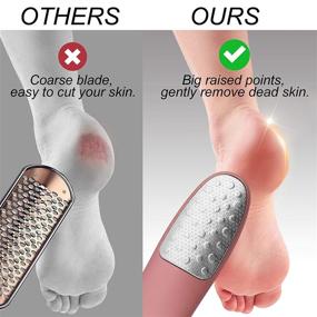 img 3 attached to 🦶 Ultimate Foot Scrubber with Stand: Never-Cut-Your-Feet Callus Remover - Safe, Comfortable, and Effective for Wet/Dry Feet - Best Home Pedicure Foot Care Tool!