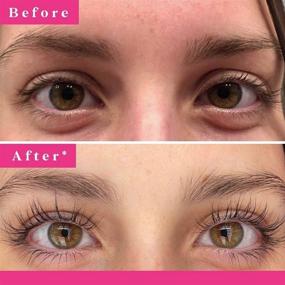 img 2 attached to 👁️ GrandeLash MD Lash Enhancing: Achieve Longer, Thicker Eyelashes 3x Faster! 3-Month Supply